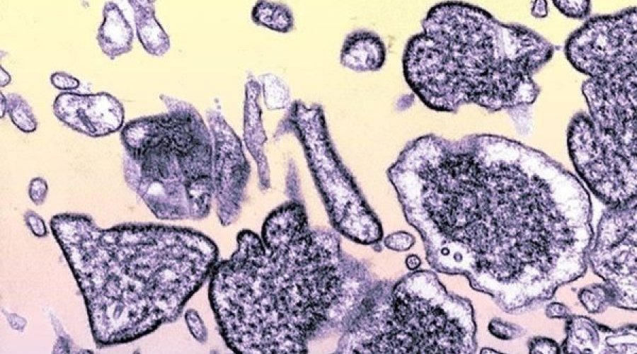 [Estudo revela 35 casos em humanos de novo vírus de origem animal na China]