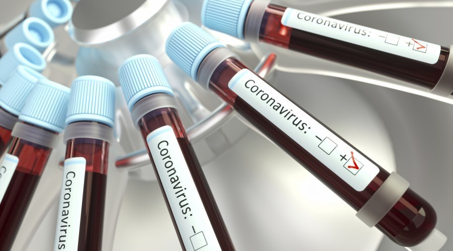 [Bahia registra 4.038 novos casos de coronavírus e 69 óbitos nas últimas 24 horas]