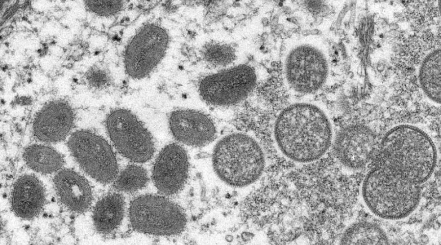 [São Paulo confirma terceiro caso de varíola dos macacos no estado]